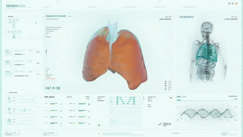 Biotechnology Analysis Using Medical Data Is Running In Modern Computer Software Vídeo Stock 205613794