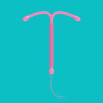 Birth Control Concept. Pink T Shape IUD Copper Intrauterine Device in Duoto.. Stock Illustration