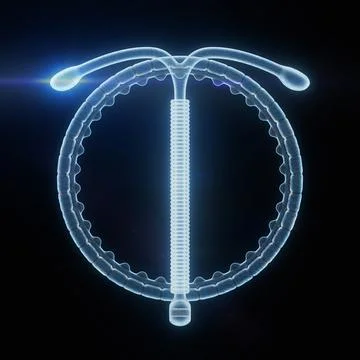 Birth Control Concept. X-Ray T Shape IUD Copper Intrauterine Device. 3d Ren.. Stock Illustration