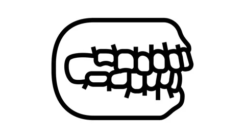Bite correction line icon animation Stock Footage 224416909