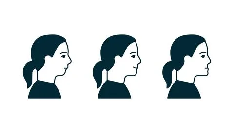 Bite normal jaw and malocclusion, face woman in profile set. Dental problem Stock Illustration