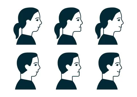 Bite normal jaw and malocclusion, face man an woman in profile set. Dental pr Stock Illustration