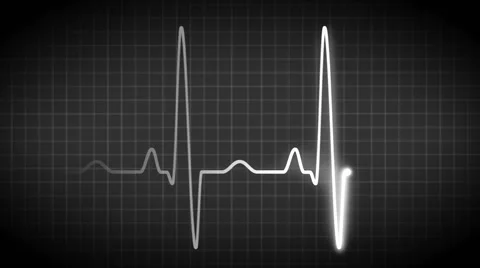 Black and white ECG graph Stock-Footage 48761529