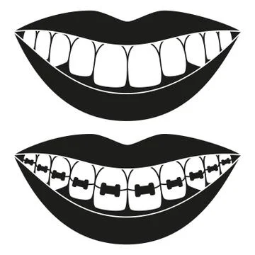 Black and white teeth aligning elements silhouette イラスト素材