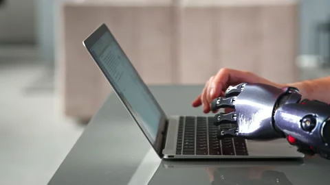 Black bio limb prothesis and healthy hand appear over laptop Stock Footage 157331085