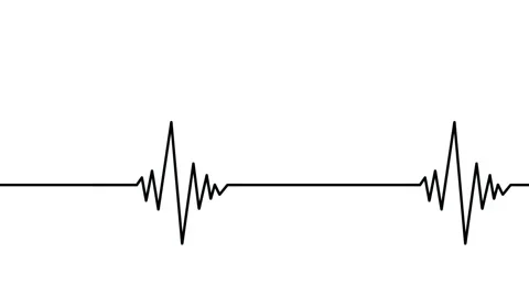 Black heartbeat diagram, Electrocardiogr... | Stock Video | Pond5