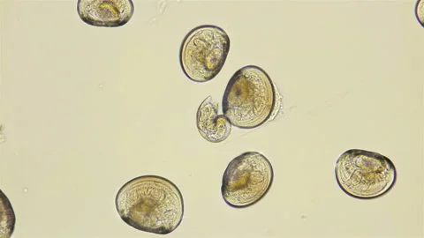 Plankton Video Stock Videos – Royalty-Free HD & 4K Videos | Page 5