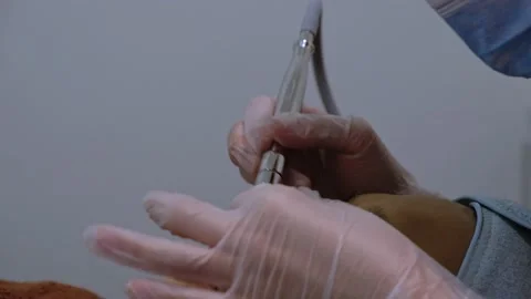 Blackhead removal procedure using vacuum suction Stock Footage 148192787