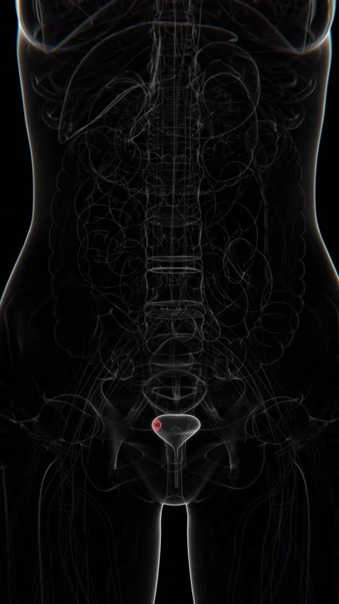 Bladder Cancer indication X-ray Vertical HQ Video Stock Footage 302148848