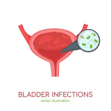 Bladder infections icon. Editable vector illustration. Medical concept Stock Illustration