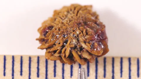 Bladder Stone Stock Footage 39854643