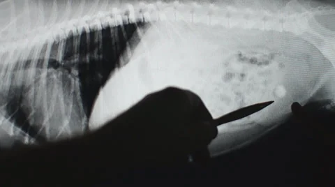 Bladder Stone Radiograph Video stock 39885193