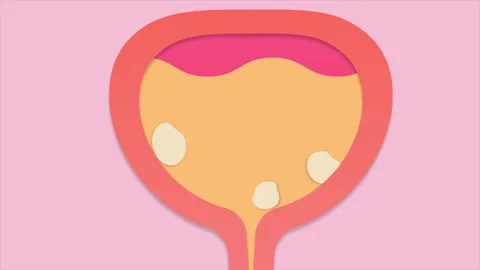 Bladder stones. Abstract loop animation Stock Footage 303935784