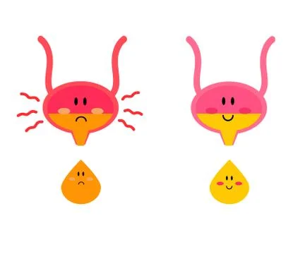 Bladder on a white background. Cystitis. Stock Illustration