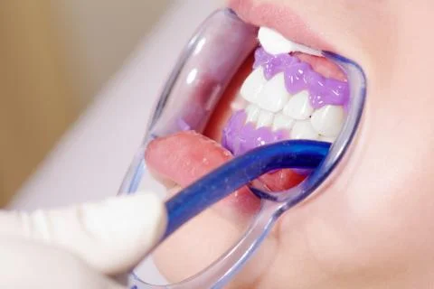 Bleaching close up Stock Photos