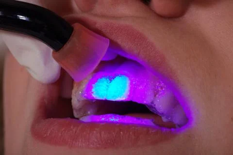 Bleaching close up Stock Photos