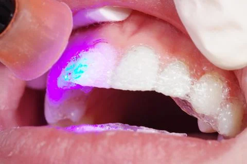 Bleaching close up Stock Photos