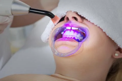 Bleaching close up Stock Photos