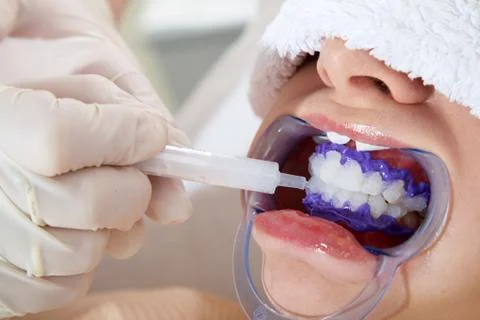 Bleaching close up Stock-Fotos