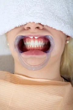 Bleaching close up 库存照片