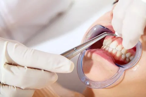 Bleaching close up Stock Photos