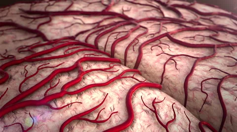 Bleeding on a brain Stock Footage 43787872