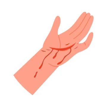 Bleeding cut on human hand Stock Illustration