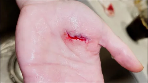 Bleeding cut wound on human hand close up 스톡 동영상 328327563