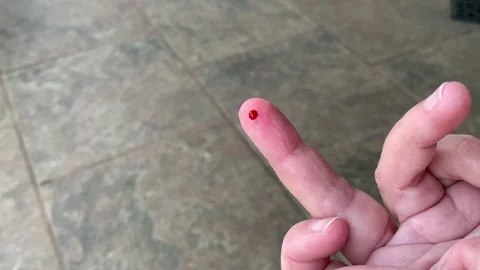 Bleeding finger Stock Footage 160850667