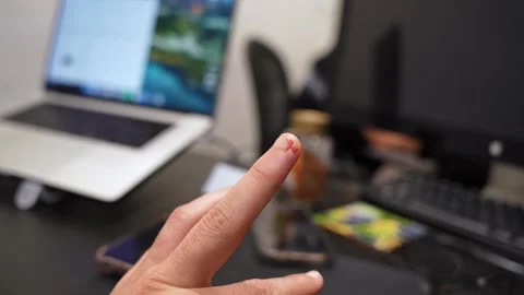 Bleeding finger at office desk Stock Footage 336643788