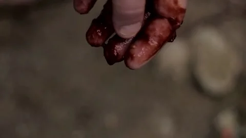 Bleeding Vídeo Stock 171666381