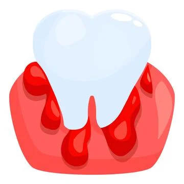 Bleeding gums and tooth indicate gum disease Stock Illustration