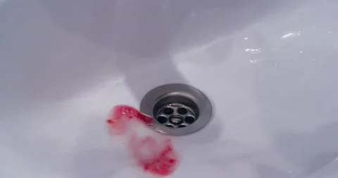 Bleeding Gums Stock Footage 139323154