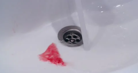 Bleeding Gums Stock Footage 139511263