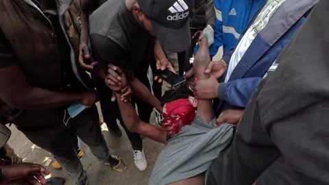 A bleeding man is carried by demonstrators. 스톡 동영상 311483580