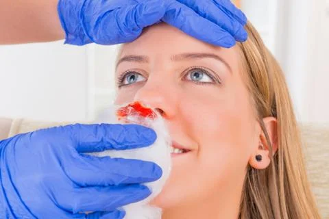Bleeding nose emergency Stock Photos