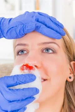 Bleeding nose emergency Stock Photos