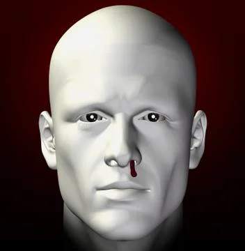Bleeding nose Stock Illustration
