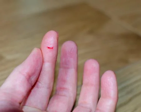 Bleeding from sharp cut wound at left  index. Finger cut, bleeding injured wi Stock Photos
