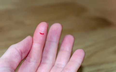 Bleeding from sharp cut wound at left  index. Finger cut, bleeding injured wi Stock Photos