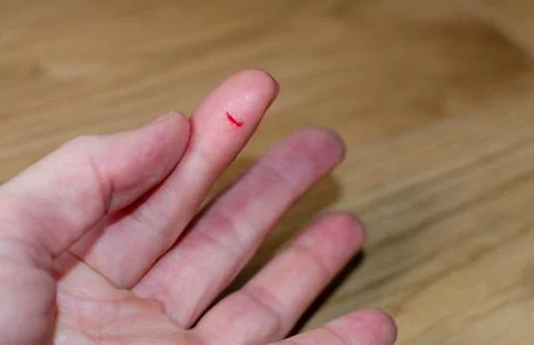 Bleeding from sharp cut wound at left  index. Finger cut, bleeding injured wi Stock Photos