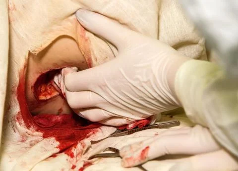 Bleeding stop Stock Photos