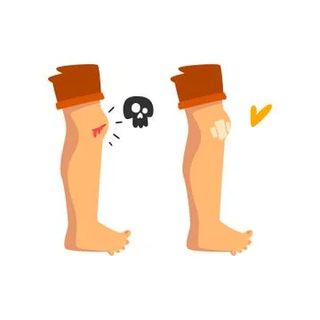 Bleeding wound on the knee, sticking plaster, physical injury, first aid and Illustrazione stock