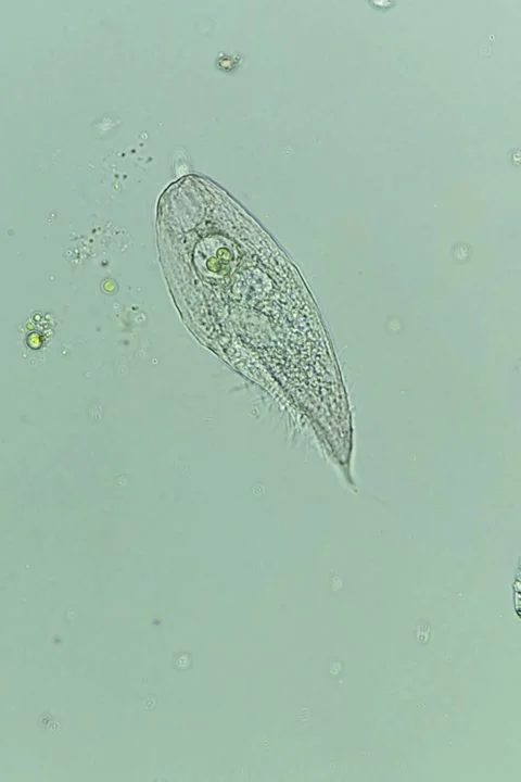 Blepharisma Ciliate Under Polarized Light Microscopy, Microscopic Video Stock Footage 334339150
