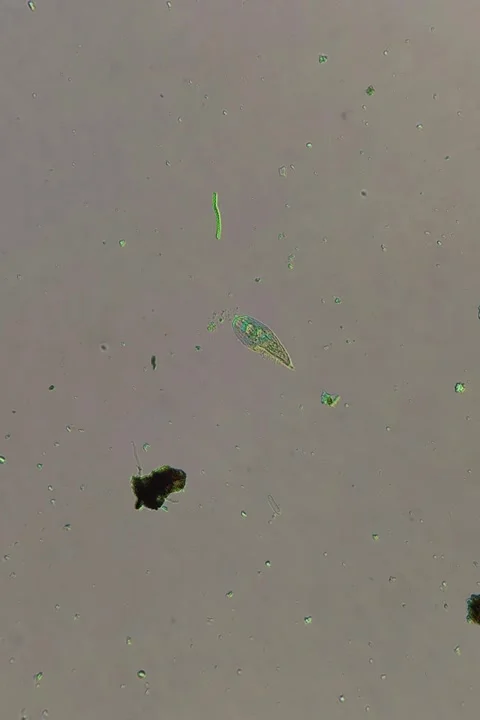 Blepharisma Ciliate Under Polarized Light Microscopy Video Stock Footage 334339173