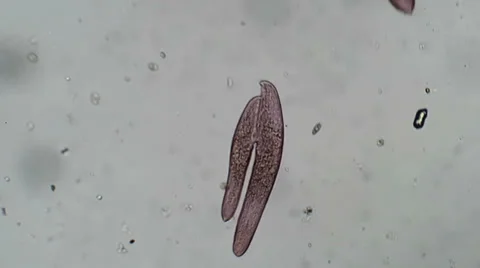 Blepharisma in Conjugation Video stock 37036954