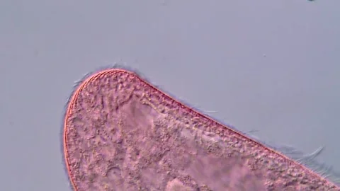 Blepharisma in pond water under DIC microscopy, Pink ciliophora protozoa 库存影片 317634087