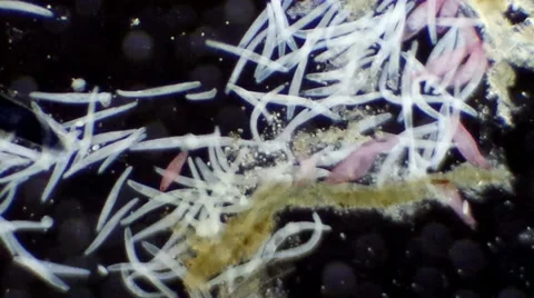 Blepharisma vs Spirostomum Video stock 37235837