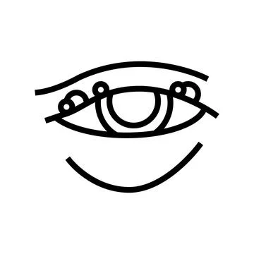 Blepharitis disease, redness of eyeball line icon vector illustration Illustrazione stock