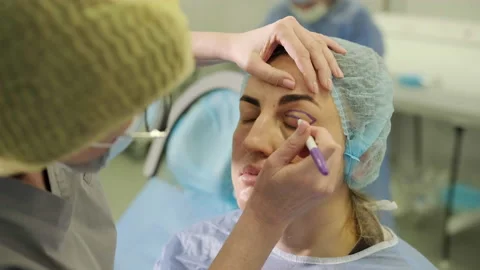 Blepharoplasty plastic surgery operation, focused on rejuvenation Stock Footage 234812202